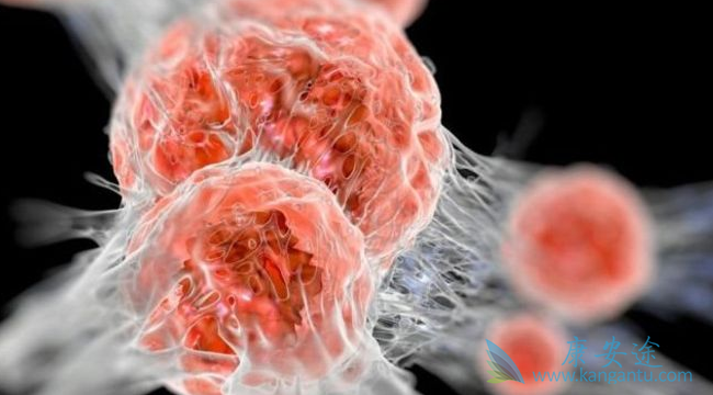 乳腺癌;治疗癌症 乳腺癌;治疗癌症