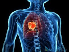 �ΰ������ð���ҩ��ķ�����������