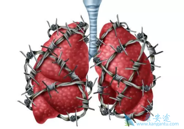 肺癌药;肺癌治疗 肺癌药;肺癌治疗