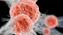 ��ϸ��ת�ƺ��������𣿰������ƺ������Ʒ���ʲô����