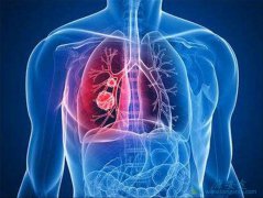 �ΰ���ȫ����������ߵļ��� �ΰ�egfr��ʲô