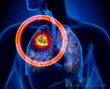 ��������Ӧ����ôʹ�ã��ΰ�EGFRҩ���ѳ�Ϊ�������Ƶ��ȵ�