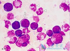 ������ϸ����Ѫ����ʲô����������ά��������