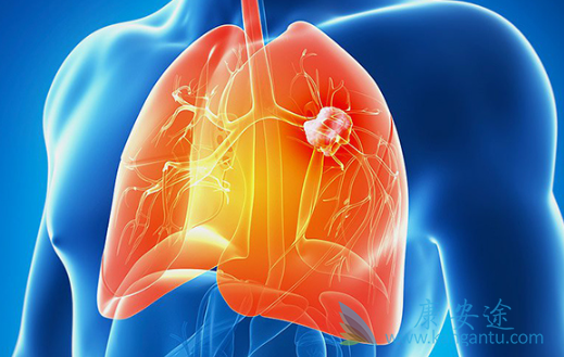 肺癌的治疗 肺癌的治疗