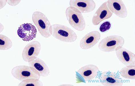 慢粒白血病 慢粒白血病