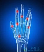 ���׿��������Ʒ�ʪ�ؽ��׵�ҩ���𣿦��׿���Ч������