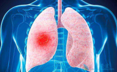 �ΰ�������ѡ��ʲô�ΰ�ҩ��ȽϺã�