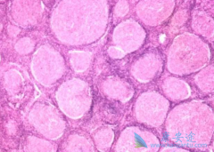 �����Ʒ��ڷǻ�����ܰ���������ЩӦ�ã�