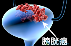 ���װ�������֢״������ͨ���Ǽ�Ъ�Ե�