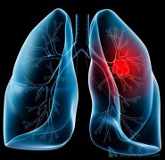 �������ƺ������������ַ�ʽ���ʺϷΰ������Ʒ�ʽ��