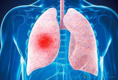 Ӧ��ѡ����ô���İ������Ʒ��������зΰ����ƣ�