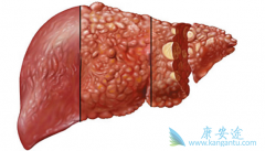 ʲô���������׷����ΰ���Ŀǰ���ڸΰ�ҩ�ﶼ����Щ��