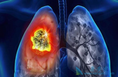 �ΰ������Ʒ�ʽ����Щ�����������������µ����Ʒ�ʽ