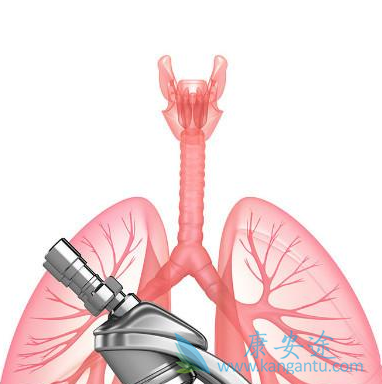 肺癌晚期特效药;肺癌晚期怎么治疗 肺癌晚期特效药;肺癌晚期怎么治疗