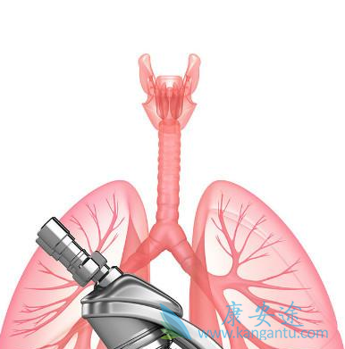 肺癌晚期;肺癌晚期治疗 肺癌晚期;肺癌晚期治疗