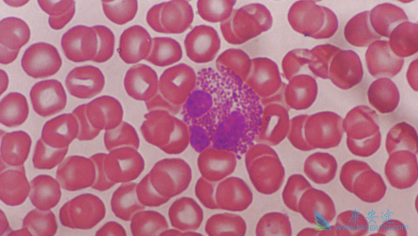 靶向药;格列卫二代 靶向药;格列卫二代