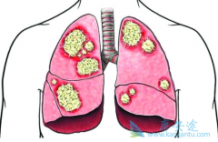 �ΰ�EGFRҩ��Բ�ͬ�ΰ�egfr�е���Ч������ͬ