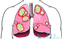 �ΰ�������ô�������ܷ����ȥ�Ĺؼ�