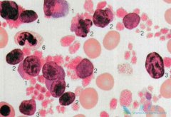 ʲô�Ǽ�����ϸ����Ѫ������ϸ�����Եõ�������