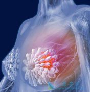 内分泌治疗晚期乳腺癌的效果怎么样？