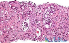 ����ת����ô�죿����ǰ���ٰ���׼�жϷ����ǹؼ�