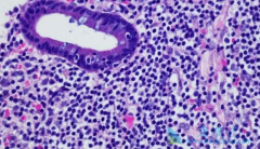 ��ô���ƺ�ɫ����ϸ������������ϸ�����ܷ�����ҩ��