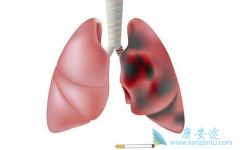 �ΰ���֢״����Щ����ô���Ʒΰ���