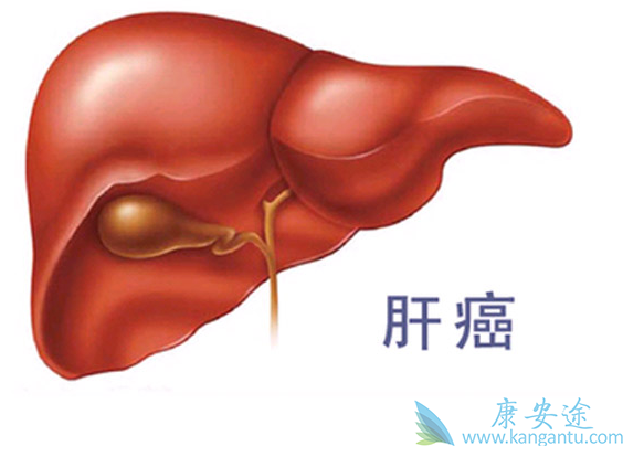 肝癌的早期症状;肝癌治疗 肝癌的早期症状;肝癌治疗