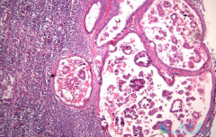 ���˶�������ϸ���𣿺ܶ���������ǰ�������������Ľ׶�