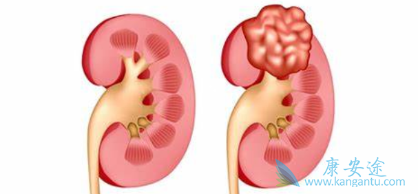 索坦;多吉美 索坦;多吉美