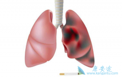 �ΰ���������������Сϸ���ΰ�ռ�ȶ��٣�