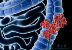 ߻��������ӳ���ֱ������ת�ƻ��ߵ���������