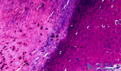 ��ɫ�����Ƕ��Գ̶ȸ߷���������Ѹ�ٵ�����֮һ