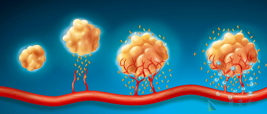 良性肿瘤;恶性肿瘤 良性肿瘤;恶性肿瘤