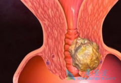 �ѳ������׸����𣿻��߶��������ƺ󸴷�����������Щ��