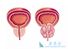 ��������ǰ���ٰ���ʲô���ı����أ�