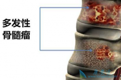 ���ڹ������ܻ��ã���ʲôҩ���ã�