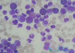 ��Щ����ҩ��ר�����������Ѫ����