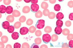 ��������������ܰ�ϸ����Ѫ������Ч��ô����