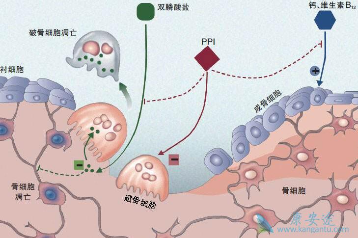 双膦酸盐 双膦酸盐