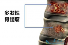 �෢�Թ������ܻ���������֢״���