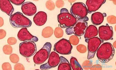 ���������������԰�Ѫ�����߲���ͣ����������