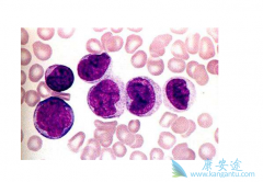 �����԰�Ѫ���ǹ�����Ѫ��ϸ����������