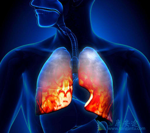 肺癌晚期 肺癌晚期