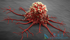 ��μ��ᰩ֢��ʹ�ࣿ��ν�������ɱ��ҡ���У�