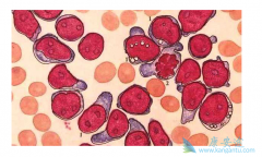 ������Ѫ������Ϊ������Ѫ��ϸ�����㵼�µ���