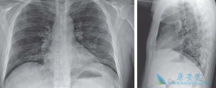 瑞德西韦 瑞德西韦