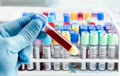 �ط����(EMFLAZA)���гɱ�Ч������