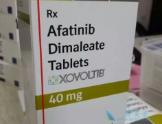 ��������Ĺ���ԭ����ʲô