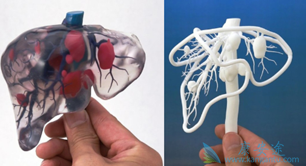 IBM Waston˹ܺڿƼҽʹҽԺۣ